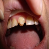 οδοντιατρείο Εύας Κασιμάτη